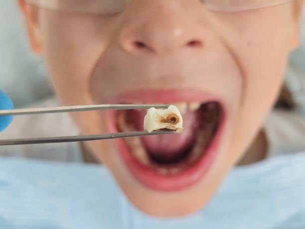 Best Emergency Tooth Extraction  in East Palestine, OH